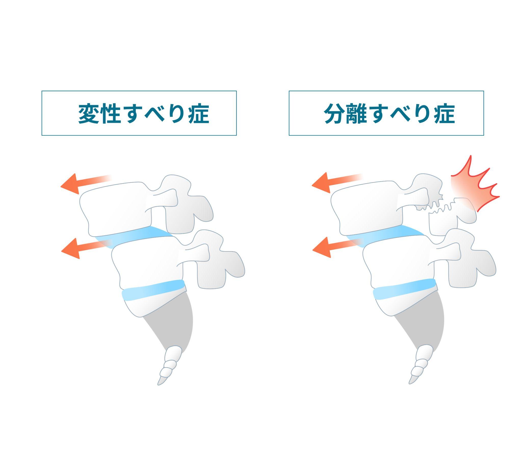 腰痛図③